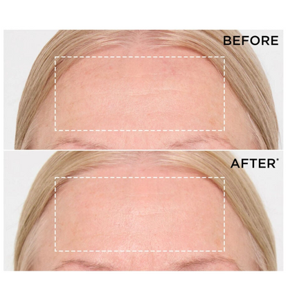 Renewal Active Serum