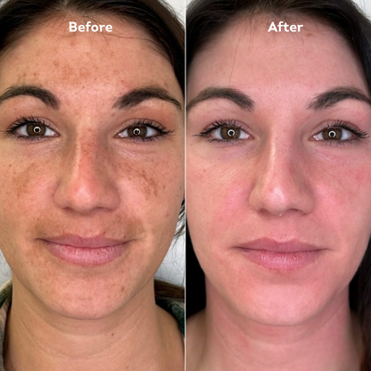 Turmeric Facial Cleansing Soap