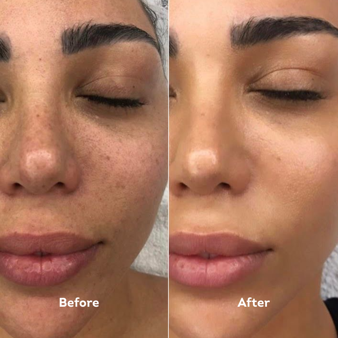 Turmeric Facial Cleansing Soap