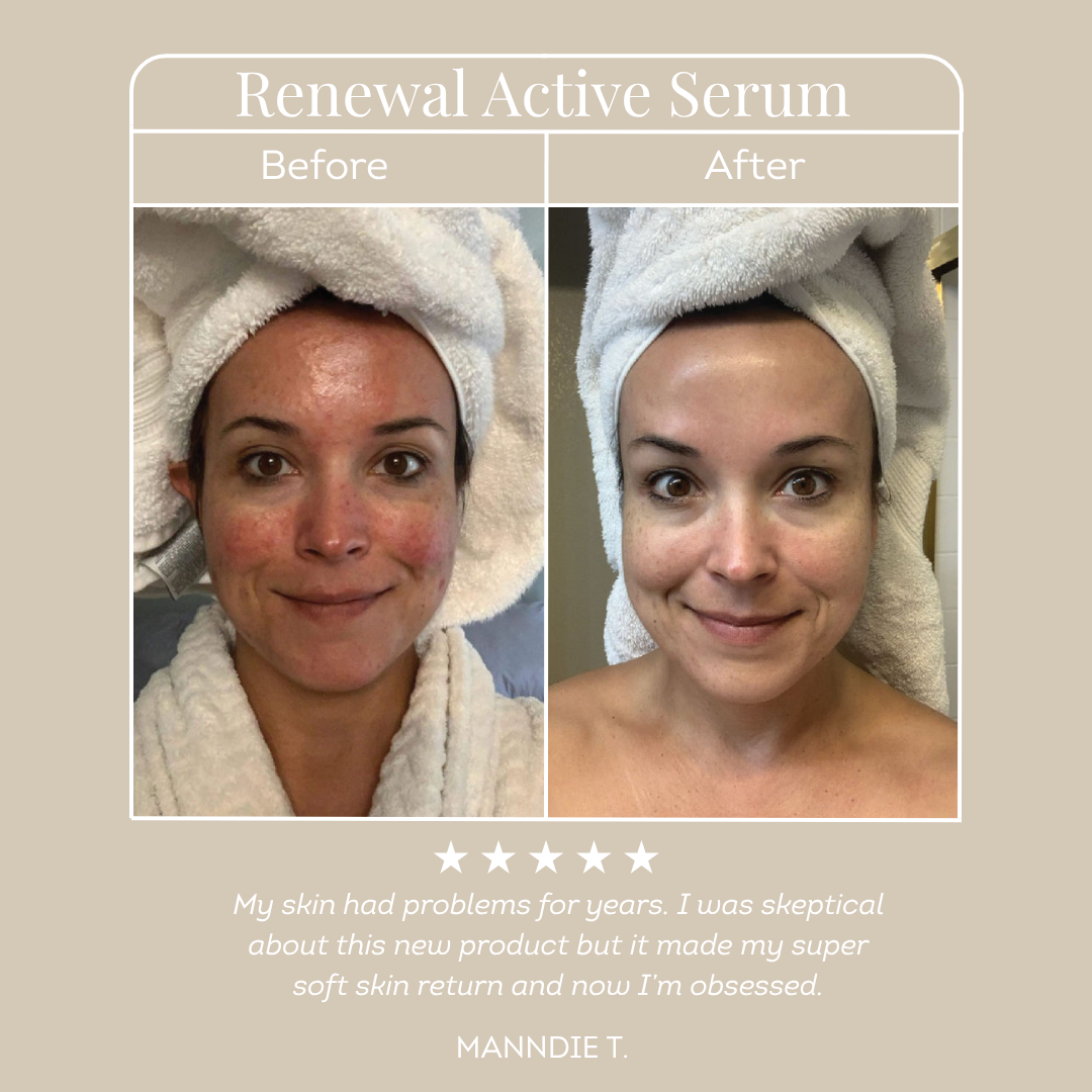 Renewal Active Serum