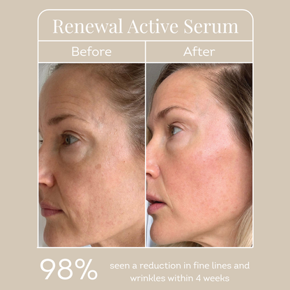 Renewal Active Serum