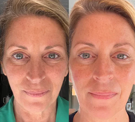 <p>Trusted by Women Who Expect Results</p>